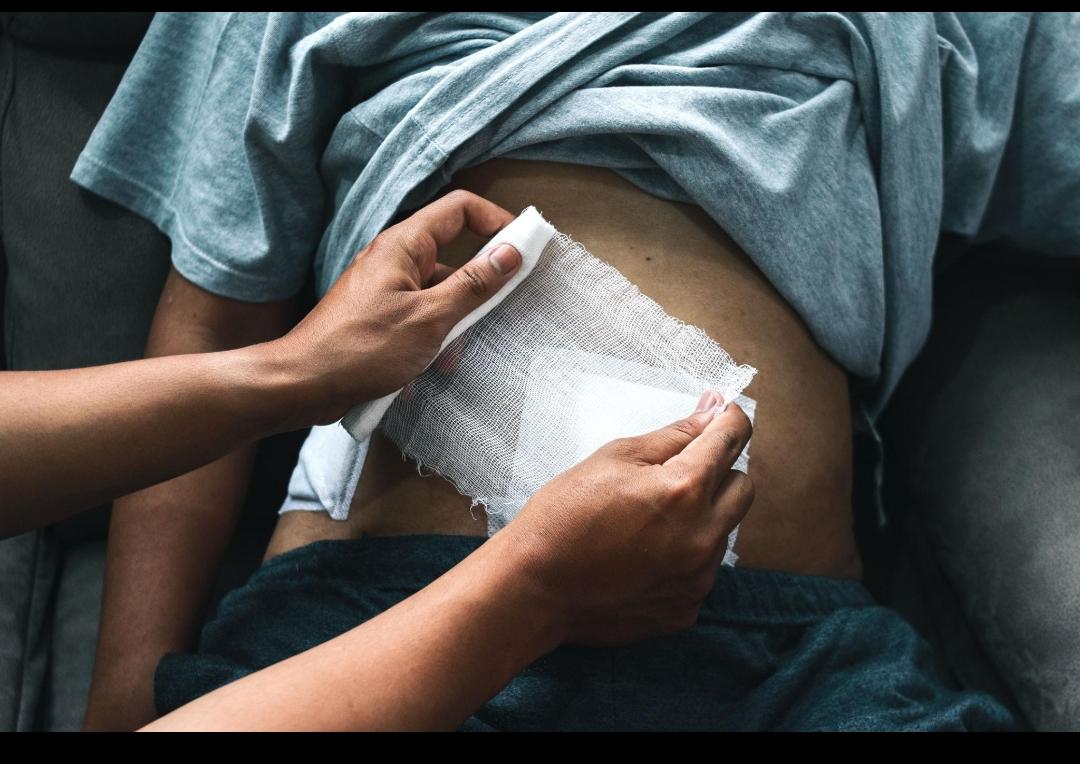 Post-Surgery Care